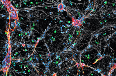 Tri-culture of neurons, microglia, and astrocytes Hoechst Iba1 GFAP Tuj1